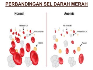 PERBANDINGAN SEL DARAH MERAH
 