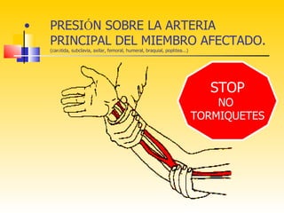 •   PRESIÓN SOBRE LA ARTERIA
    PRINCIPAL DEL MIEMBRO AFECTADO.
    (carótida, subclavia, axilar, femoral, humeral, braquial, poplítea...)




                                                                               STOP
                                                                                 NO
                                                                             TORMIQUETES
 