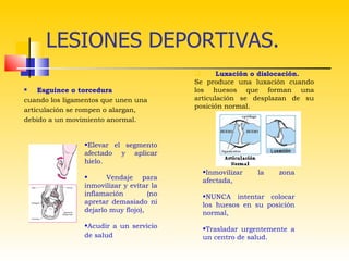 LESIONES DEPORTIVAS.
                                                Luxación o dislocación.
                                          Se produce una luxación cuando
   Esguince o torcedura                  los huesos que forman una
cuando los ligamentos que unen una        articulación se desplazan de su
                                          posición normal.
articulación se rompen o alargan,
debido a un movimiento anormal.


                •Elevar el segmento
                afectado y aplicar
                hielo.
                                            •Inmovilizar   la   zona
                •      Vendaje para         afectada,
                inmovilizar y evitar la
                inflamación         (no     •NUNCA intentar colocar
                apretar demasiado ni        los huesos en su posición
                dejarlo muy flojo),         normal,
                •Acudir a un servicio       •Trasladar urgentemente a
                de salud                    un centro de salud.
 