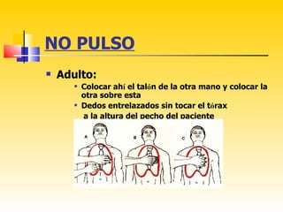 NO PULSO
   Adulto:
          Colocar ahí el talón de la otra mano y colocar la
           otra sobre esta
          Dedos entrelazados sin tocar el tórax
           a la altura del pecho del paciente
 