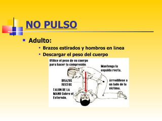 NO PULSO
   Adulto:
          Brazos estirados y hombros en línea
          Descargar el peso del cuerpo
 