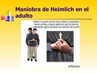 Maniobra de Heimlich en el
adulto
 