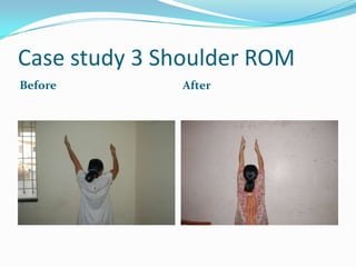 Case study 3 Shoulder ROM
Before        After
 