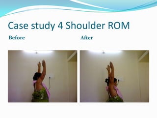 Case study 4 Shoulder ROM
Before        After
 