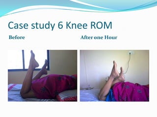 Case study 6 Knee ROM
Before        After one Hour
 