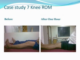 Case study 7 Knee ROM

Before          After One Hour
 