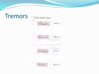 Tremors
 