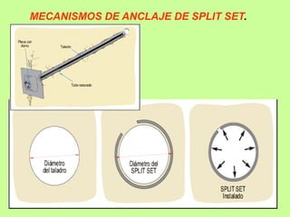 MECANISMOS DE ANCLAJE DE SPLIT SET.
 