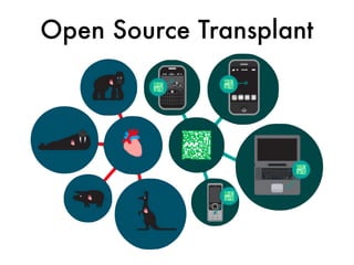 Open Source Transplant
 