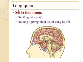  Sốt là tình trạng:
◦ Gia tăng thân nhiệt
◦ Do tăng ngưỡng nhiệt độ tại vùng hạ đồi
Tổng quan
3
 