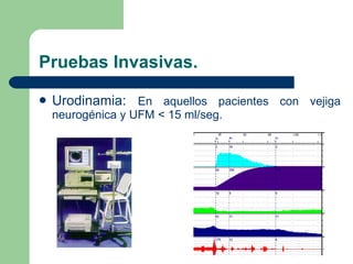 Pruebas Invasivas. Urodinamia:  En aquellos pacientes con vejiga neurogénica y UFM < 15 ml/seg. 