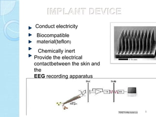 Conduct electricity
 Biocompatible
 material(teflon)
  Chemically inert
Provide the electrical
contactbetween the skin and
the
EEG recording apparatus




                              8
 