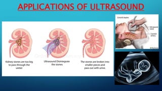 APPLICATIONS OF ULTRASOUND
 