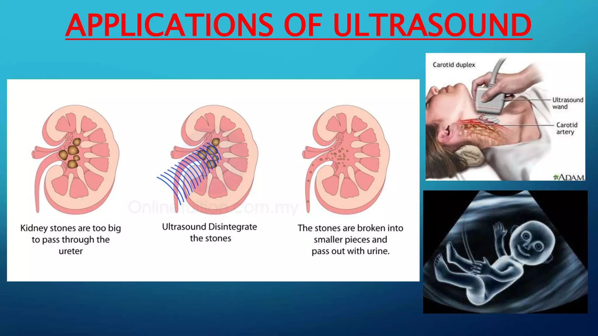 APPLICATIONS OF ULTRASOUND
 