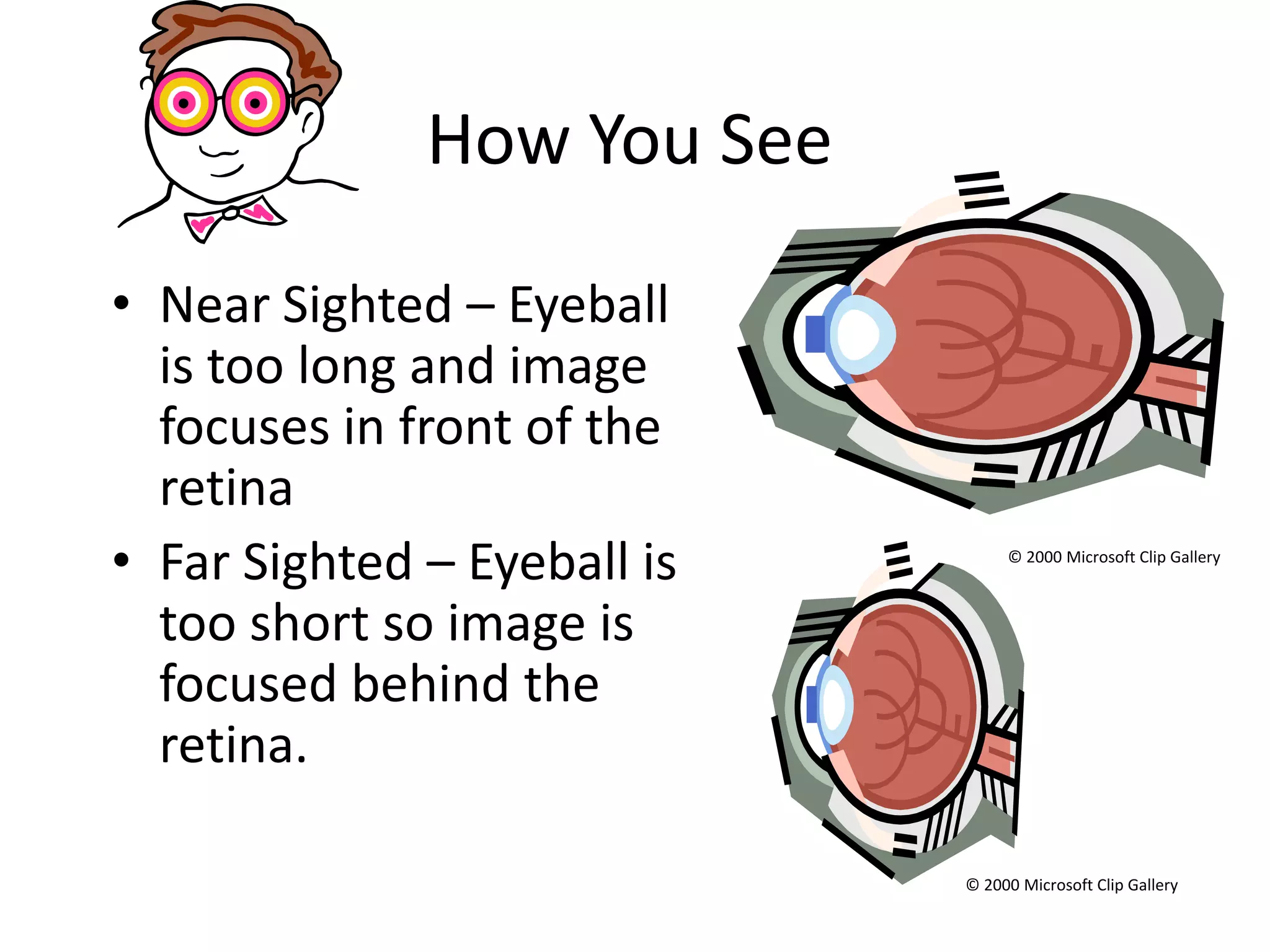 How You See

• Near Sighted – Eyeball
  is too long and image
  focuses in front of the
  retina
• Far Sighted – Eyeball is        © 2000 Microsoft Clip Gallery



  too short so image is
  focused behind the
  retina.

                             © 2000 Microsoft Clip Gallery
 