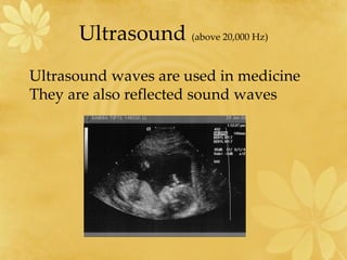 Ultrasound  (above 20,000 Hz) Ultrasound waves are used in medicine  They are also reflected sound waves 