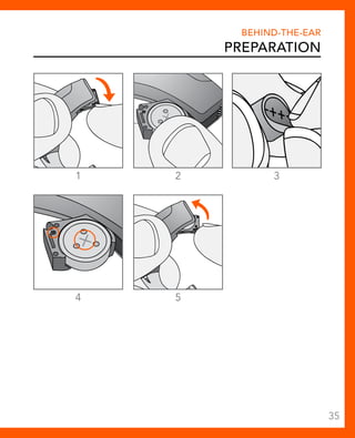 1 2 3 
4 5 
Behind-The-Ear 
Preparation 
35 
 