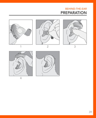 1 2 3 
4 
Behind-The-Ear 
Preparation 
39 
 
