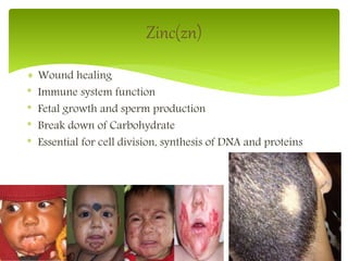 Zinc(zn)
 Wound healing
* Immune system function
* Fetal growth and sperm production
* Break down of Carbohydrate
* Essential for cell division, synthesis of DNA and proteins
10
 