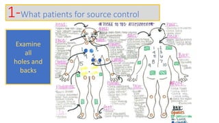 1-What patients for source control
Source of infection
Not amenable for
source control
measures
Meningitis
Sinusitis
Pneumonia
Infectious
diarrhea
Cellulitis
Amenable for source
control measures
Para-pnumonic
effusion
Acalcular
cholecystitis
Abscess
Git ischemia
and perforation
Pyelonephrit
is with
obstruction
Line
associated
infection
Examine
all
holes and
backs
 
