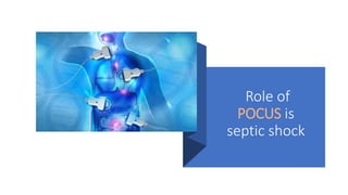 Role of
POCUS is
septic shock
 