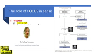 The role of POCUS in sepsis
a) Diagnose
a) Septic or no?
b) If septic where is the source?
b) Deranged physiology correction
a) USG-fluid management
b) USG-CVL
c) Drain
a) USG- pleural drain insertion
b) USG- cholecystostomy drain
c) USG- Ascitic drain
d) USG- arthrocentesis
e) USG- LP
 