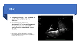 LUNG
• In early pneumonia, B lines and areas of
subpleural consolidation can be
identified;
• in later stages of pneumonia,
hepatisation, the shred sign, air, dynamic
bronchograms as well as associated
pleural effusions or empyemas can be
identified
• Llamas-Alvarez AM, Tenza-Lozano EM, Latour-Perez J. Accuracy of Lung
Ultrasonography in the Diagnosis of Pneumonia in Adults: Systematic Review and
Meta-Analysis. Chest. 2017;151(2):374-82.
 