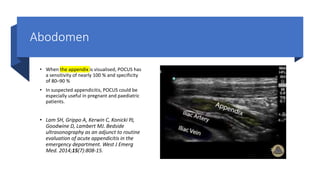 Abodomen
• When the appendix is visualised, POCUS has
a sensitivity of nearly 100 % and specificity
of 80–90 %
• In suspected appendicitis, POCUS could be
especially useful in pregnant and paediatric
patients.
• Lam SH, Grippo A, Kerwin C, Konicki PJ,
Goodwine D, Lambert MJ. Bedside
ultrasonography as an adjunct to routine
evaluation of acute appendicitis in the
emergency department. West J Emerg
Med. 2014;15(7):808-15.
 