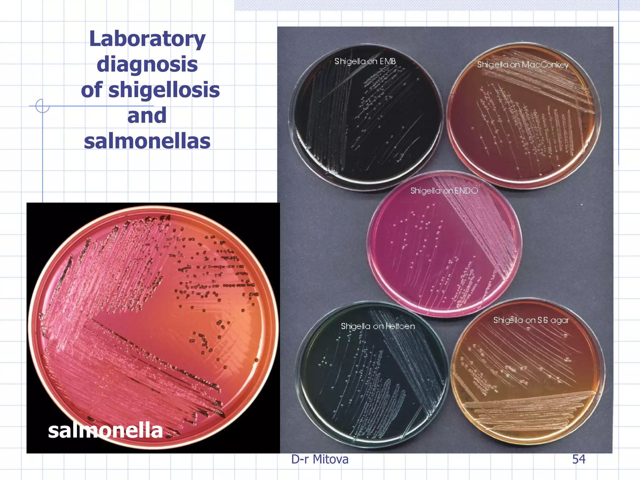 Laboratory diagnosis of shigellosis and salmonellas salmonella 