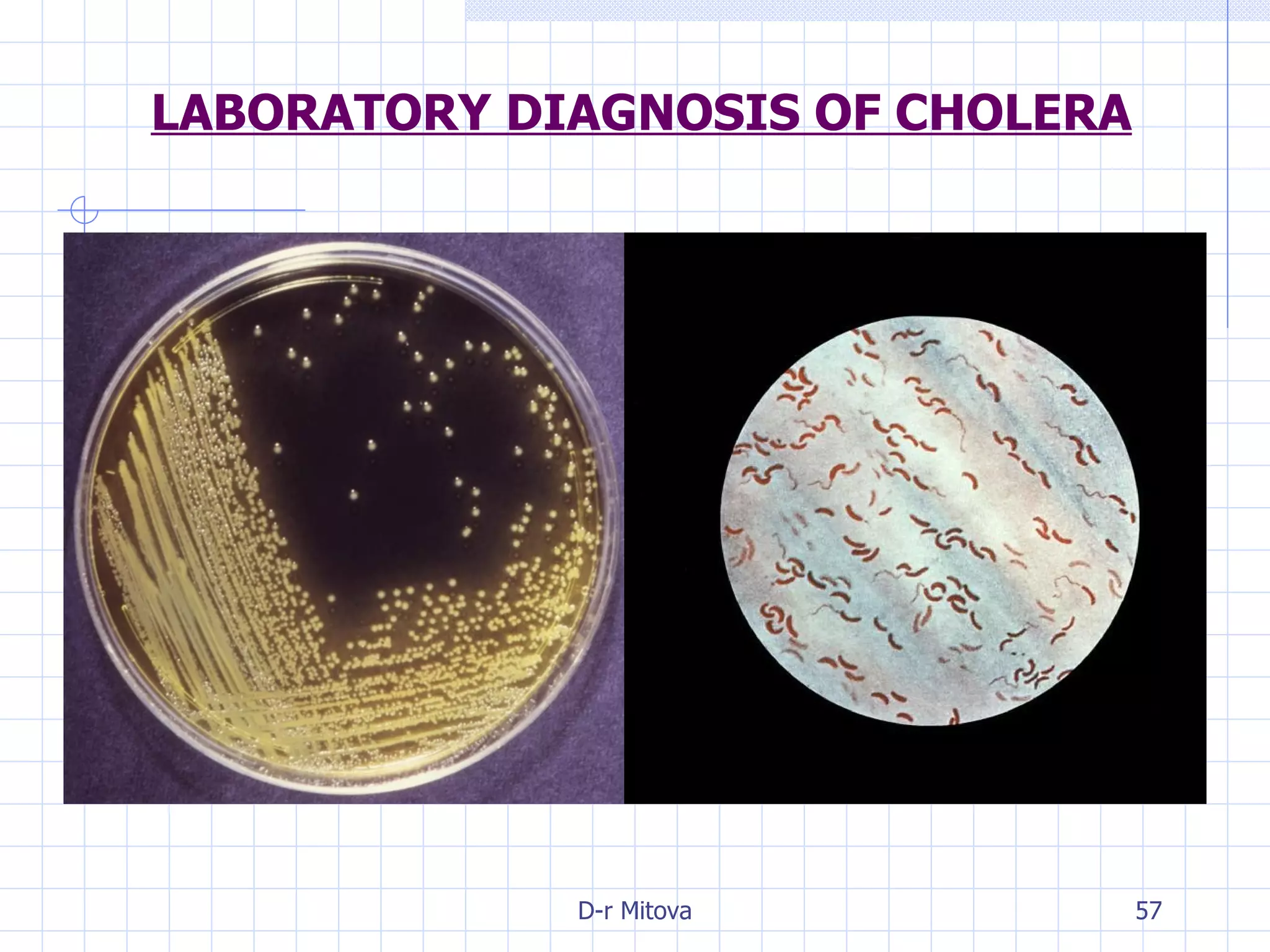 LABORATORY DIAGNOSIS OF CHOLERA 