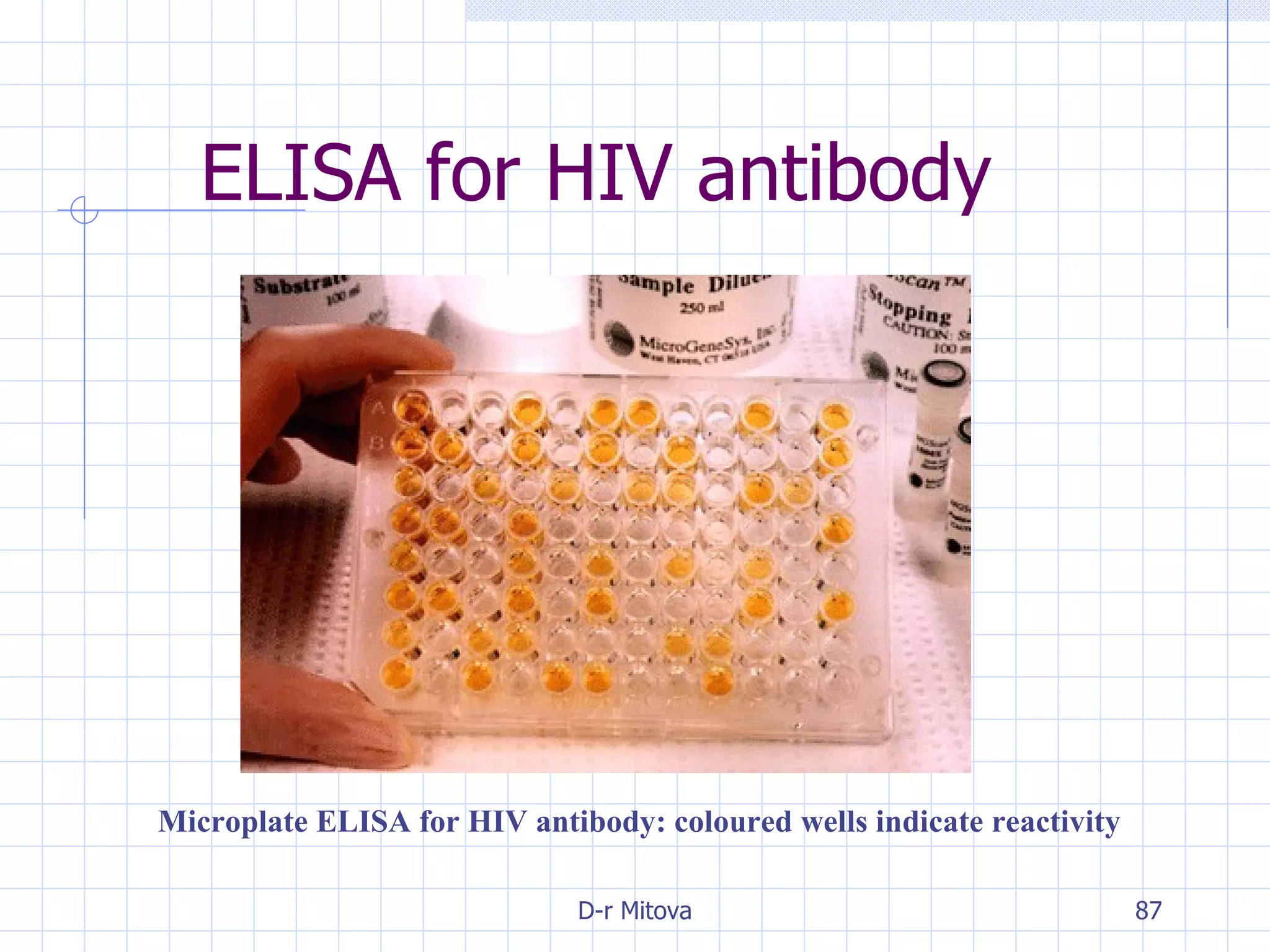ELISA for HIV antibody Microplate ELISA for HIV antibody: coloured wells indicate reactivity 