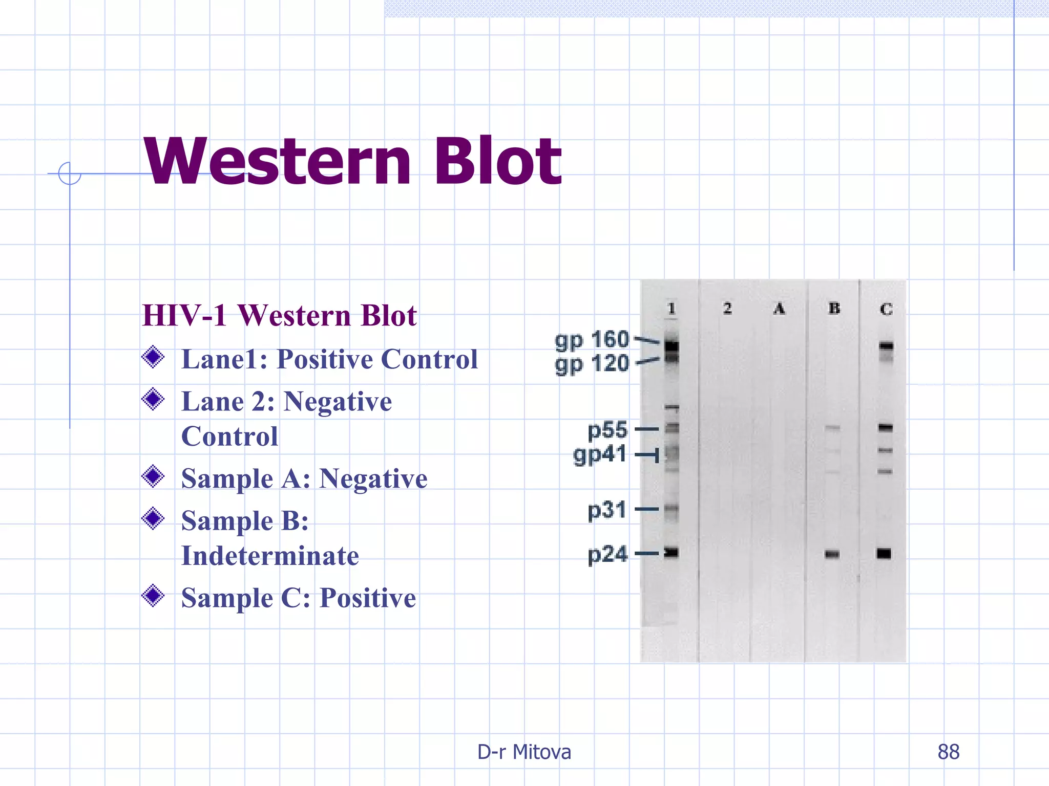 Western Blot HIV-1 Western Blot Lane1: Positive Control Lane 2: Negative Control Sample A: Negative Sample B: Indeterminate Sample C: Positive 