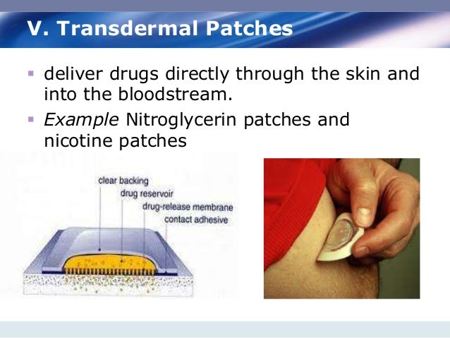 Nitroglycerin Dosage Forms