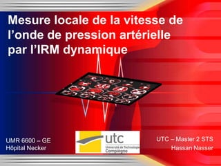 Mesure locale de la vitesse de
l’onde de pression artérielle
par l’IRM dynamique




UMR 6600 – GE            UTC – Master 2 STS
Hôpital Necker               Hassan Nasser
 