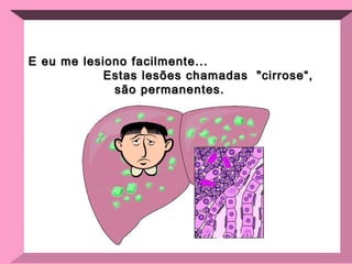 E eu me lesiono facilmente...  Estas lesões chamadas  "cirrose“, são permanentes.   