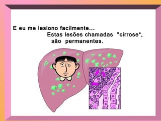 E eu me lesiono facilmente...E eu me lesiono facilmente...
Estas lesões chamadas "cirrose“,Estas lesões chamadas "cirrose“,
são permanentes.são permanentes.
 