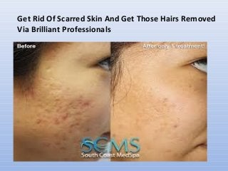 Get Rid Of Scarred Skin And Get Those Hairs Removed
Via Brilliant Professionals

 