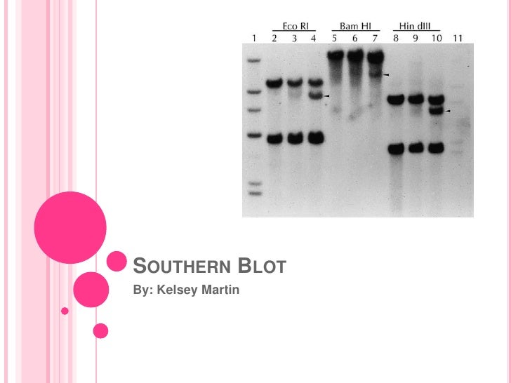 southern blot