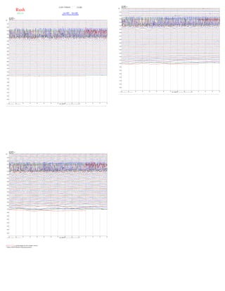 Rush
(EK14)
< SAT 07/06/2019 > Go
view HHN View HHE
Back to Seismic Recordings
RIGHT CLICK on the image to view a larger version
* Select VIEW IMAGE from pop-up menu
 