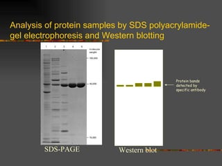 Analysis of protein samples by SDS polyacrylamide-gel electrophoresis and Western blotting Protein bands detected by specific antibody SDS-PAGE Western blot 