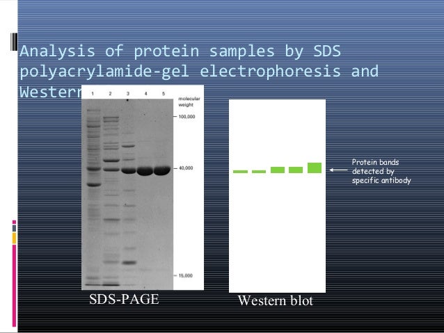 southern blotting vs northern blotting vs western blotting southern blotting vs northern blotting vs western blotting