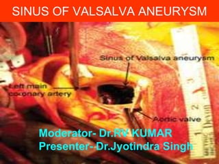 SINUS OF VALSALVA ANEURYSM

Moderator- Dr.RV KUMAR
Presenter- Dr.Jyotindra Singh

 
