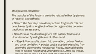 Sowmya R .colle's Fracture anatomy and physiology.pptx