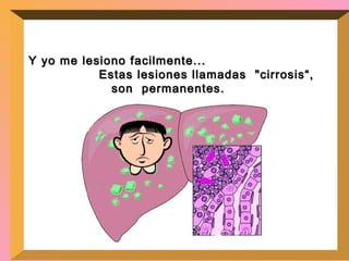 Y yo me lesiono facilmente...  Estas lesiones llamadas  "cirrosis“, son  permanentes.   