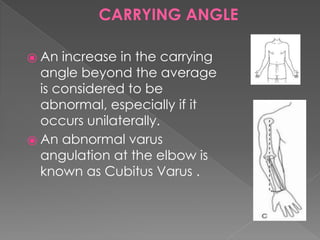 elbow_(1).pptx