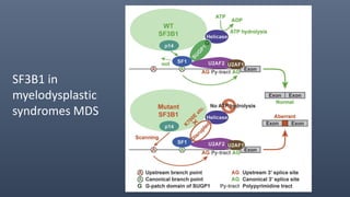 SF3B1 in
myelodysplastic
syndromes MDS
 