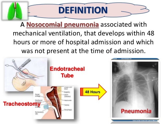 Ventilation Associated Pneumonia Vap