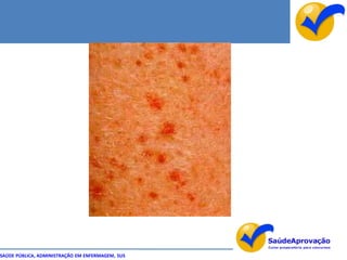 SAÚDE PÚBLICA, ADMINISTRAÇÃO EM ENFERMAGEM, SUS
 