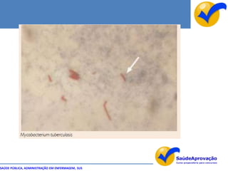 SAÚDE PÚBLICA, ADMINISTRAÇÃO EM ENFERMAGEM, SUS
 