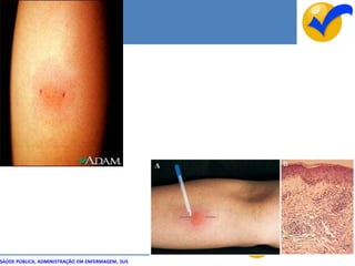 SAÚDE PÚBLICA, ADMINISTRAÇÃO EM ENFERMAGEM, SUS
 